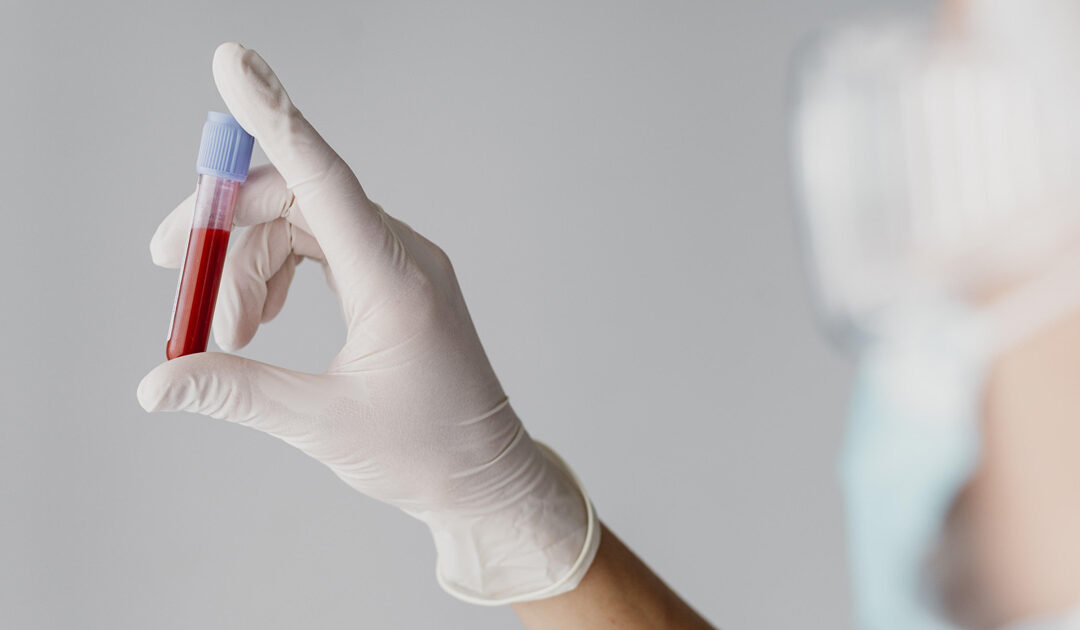 Detección de enfermedad celíaca en Laboratorio Rapela